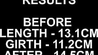 Bathmate Hydromax Penis Pump Review: Steamy Medical Fetish Fun!