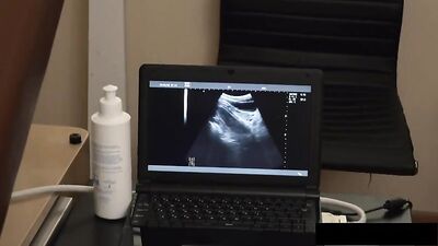 Medical Fetish: Bareback Ultrasound Twink Doctor Voyeur Cum Shot!