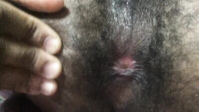 HAIRY PINK HOLE