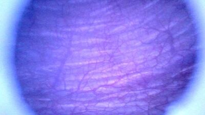 Beautiful inside POV of my full Bladder with the Endoscope Preview