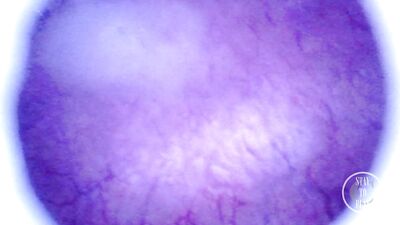 Beautiful inside POV of my full Bladder with the Endoscope Preview