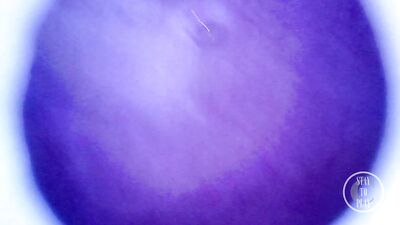 Beautiful inside POV of my full Bladder with the Endoscope Preview