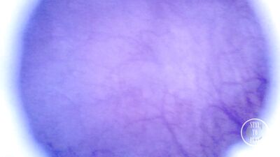 Beautiful inside POV of my full Bladder with the Endoscope Preview