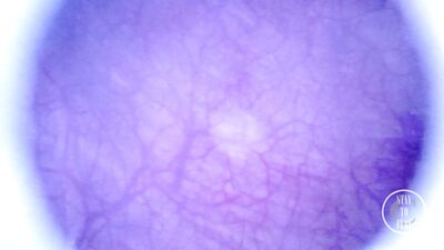 Beautiful inside POV of my full Bladder with the Endoscope Preview